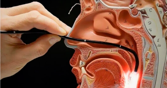 Endoscopia nasal